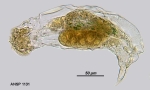 Cephalodella crassipes