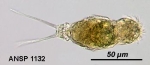 Cephalodella dorseyi
