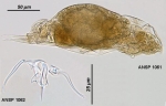 Aspelta beltista