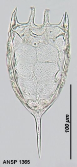 Keratella irregularis f. angulifera