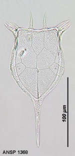 Keratella cochlearis var. faluta