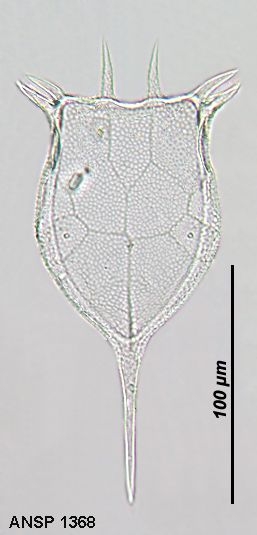 Keratella cochlearis var. faluta