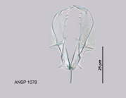 Asplanchna priodonta var. helvetica