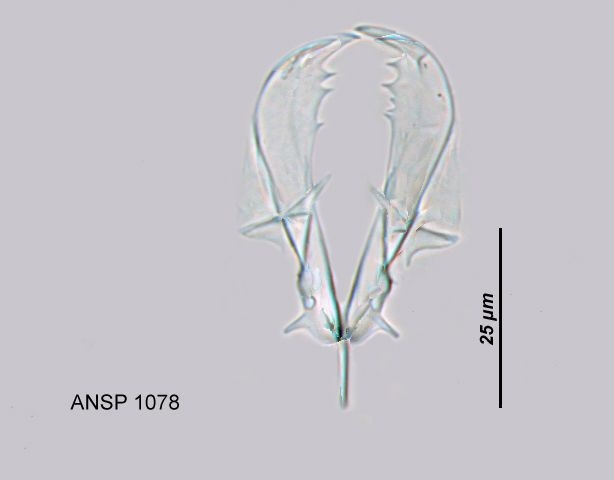 Asplanchna priodonta var. helvetica
