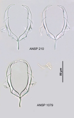 Asplanchna girodi