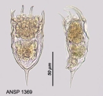 Keratella cochlearis var. hispida