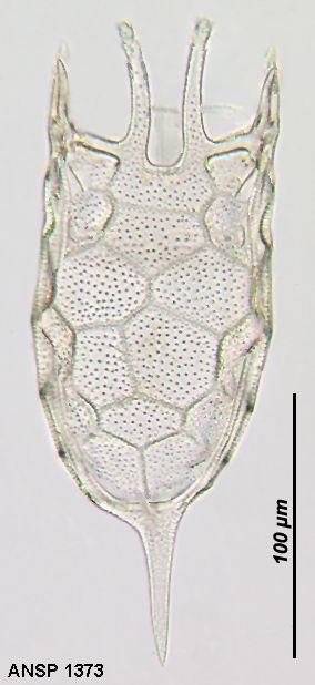 Keratella mixta