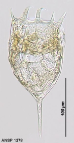 Keratella cochlearis f. robusta