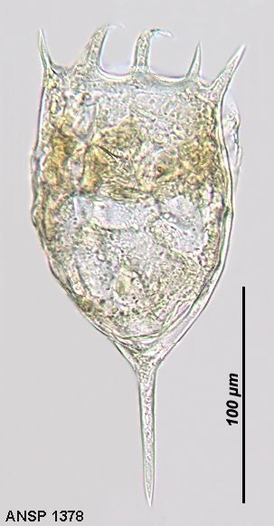 Keratella cochlearis f. robusta