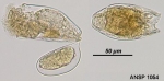Anuraeopsis fissa
