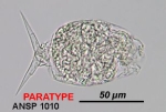 Cephalodella songkhlaensis