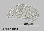 Trichocerca vernalis