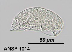Trichocerca vernalis