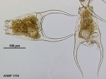 Brachionus satanicus
