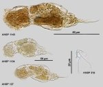 Cephalodella gracilis