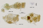 Conochilus dossuarius