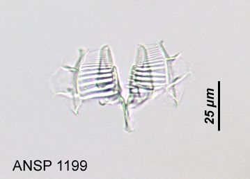 Conochilus natans