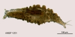 Dissotrocha macrostyla f. tuberculata