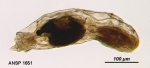 Notommata endoxa
