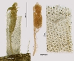 Floscularia conifera