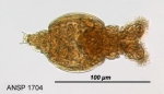 Philodina plena