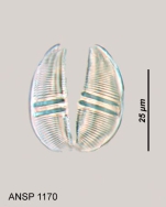 Callidina discopus