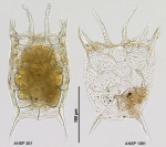Keratella serrulata