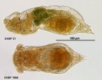 Notommata lenis