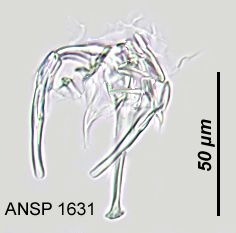Notommata glyphura