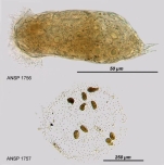 Cephalodella edax