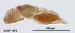 Notommata silpha