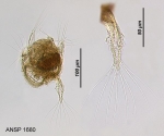 Hexarthra polychaeta