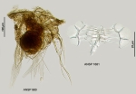 Hexarthra bulgarica