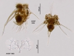 Hexarthra jenkinae