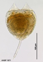 Lecane lunaris var. constricta