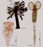 Lacinularia flosculosa