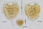 Lecane closterocerca