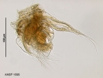 Hexarthra fennica