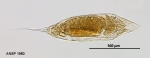 Trichocerca capucina
