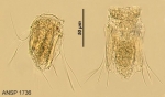 Polyarthra dolichoptera
