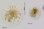 Testudinella patina f. intermedia