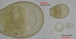 Asciaporrecta difflugicola