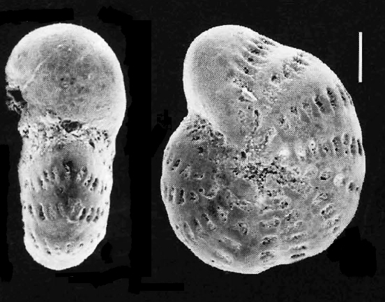 Elphidium articulatum multicameratum COLLINS 1974, toptotype