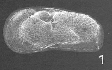 Limnocythere patagonica Cusminsky &amp; Whatley, 1996