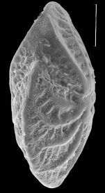 Elphidium sculpturatum Cushman, 1936, identified specimen, Western Australia, Augusta