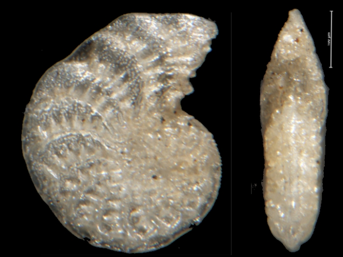 Polystomella jenseni Cushman, 1924, holotype Polystomella jenseni Cushman, 1924, holotype