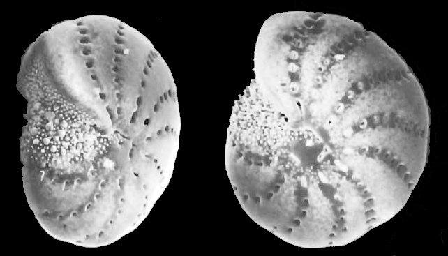 Cribrononion hawkesburiensis Albani, 1974, holotype Cribrononion hawkesburiensis Albani, 1974, holotype