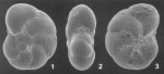 Rotalia perlucida Heron-Allen & Earland, 1913, lectotype