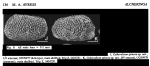 Cytheralison spinosa Ayress, 1993 from the original description