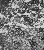 Pseudonummoloculina heimi (Bonet, 1956)